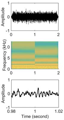 Influence of Visual Deprivation on Auditory Spectral Resolution, Temporal Resolution, and Speech Perception